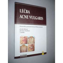 Léčba Acne vulgaris