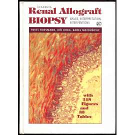 Renal Allograft Biopsy: Image, Interpretation, Interventions [renální štěpy; nefropatologie; nefrologie; medicína]